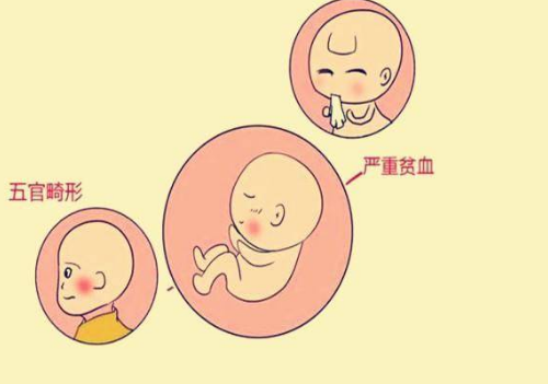 横位胎儿会不会畸形 横位孕晚期注意事项