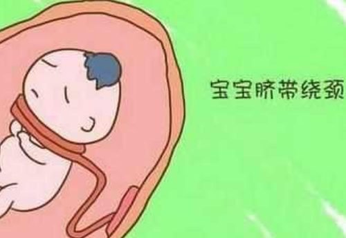 怎样胎儿才不容易绕颈 胎儿绕颈一圈怎样改善(图2) 怎样胎儿才不容易绕颈 胎儿绕颈一圈怎样改善(图2)