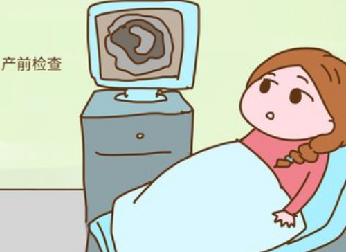 产检无创是检查什么 为什么高龄产妇慎用无创DNA(图1) 产检无创是检查什么 为什么高龄产妇慎用无创DNA(图1)