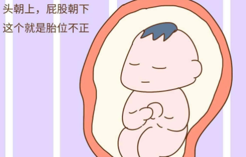 胎位不正怎么办 胎位不正的原因有哪些