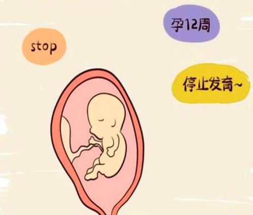 孕三个月怎么自测有没有胎停 怀孕三个月会出现胎停吗