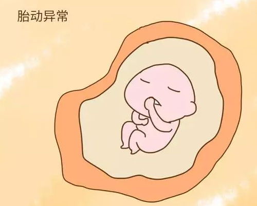 胎停了有什么明显症状 胎停是什么原因引起的(图4) 胎停了有什么明显症状 胎停是什么原因引起的(图4)