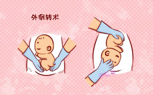 孕晚期胎儿偏大怎么办 孕晚期孩子偏大有什么影响(图3) 孕晚期胎儿偏大怎么办 孕晚期孩子偏大有什么影响(图3)