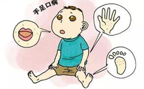 新生儿拉肚子是怎么回事 新生儿拉肚子怎么办(图1) 新生儿拉肚子是怎么回事 新生儿拉肚子怎么办(图1)