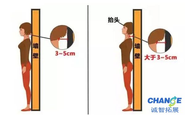 矫正驼背的4个方法
